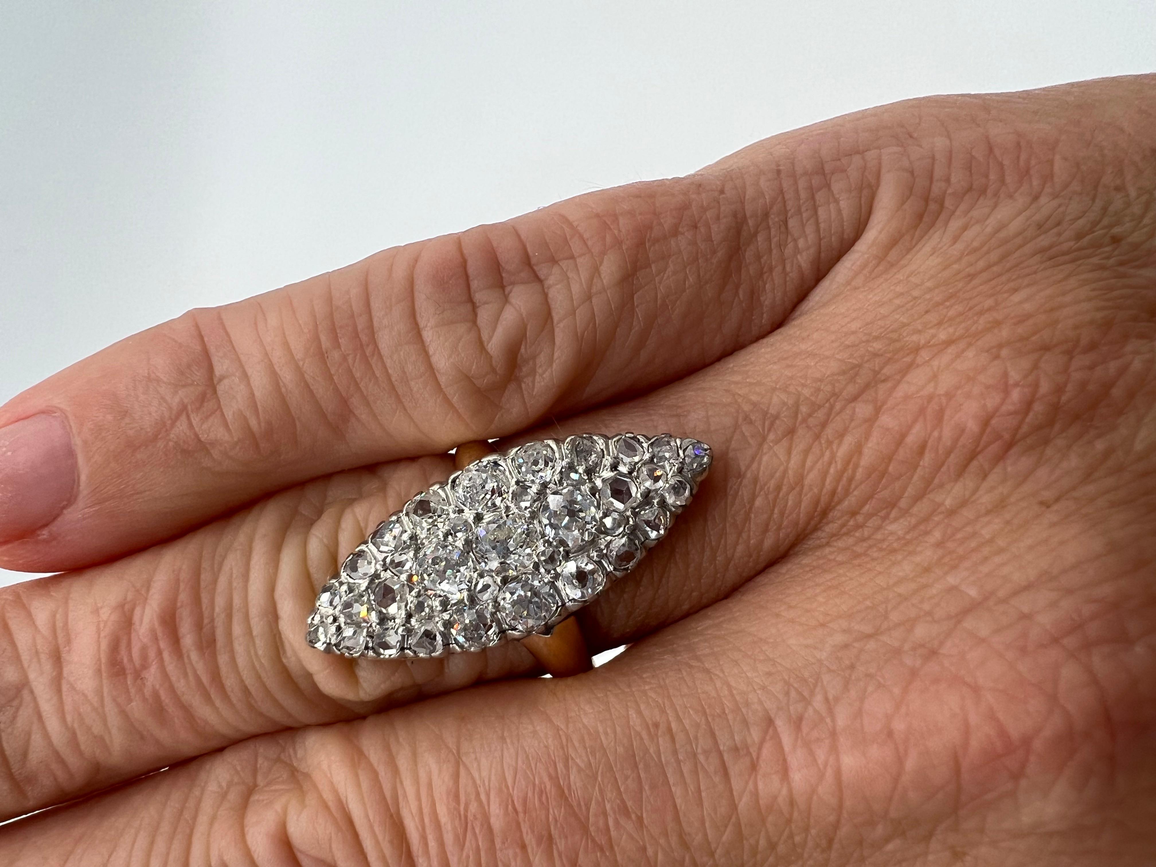 Anillo 
