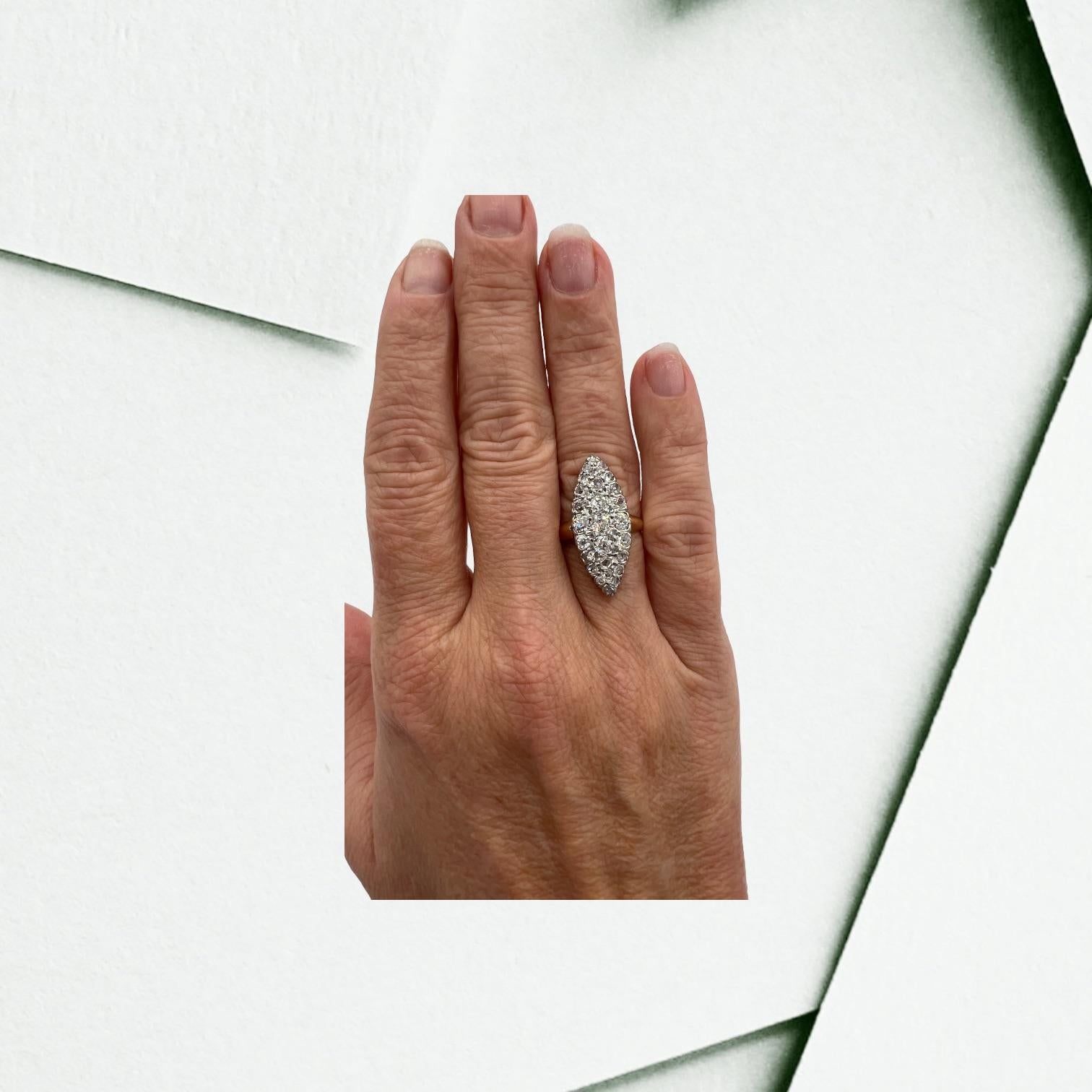 Anillo 