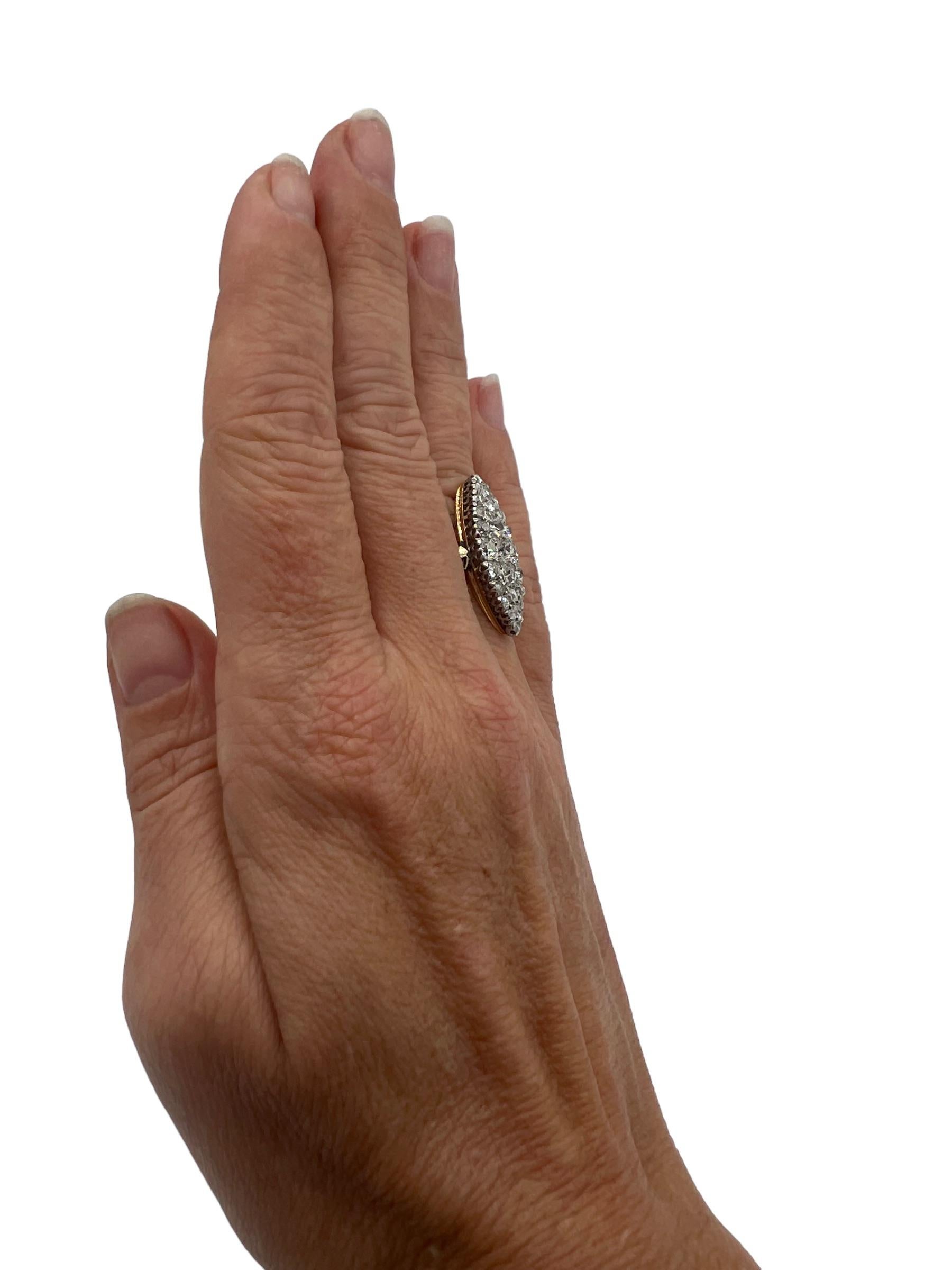Anillo 
