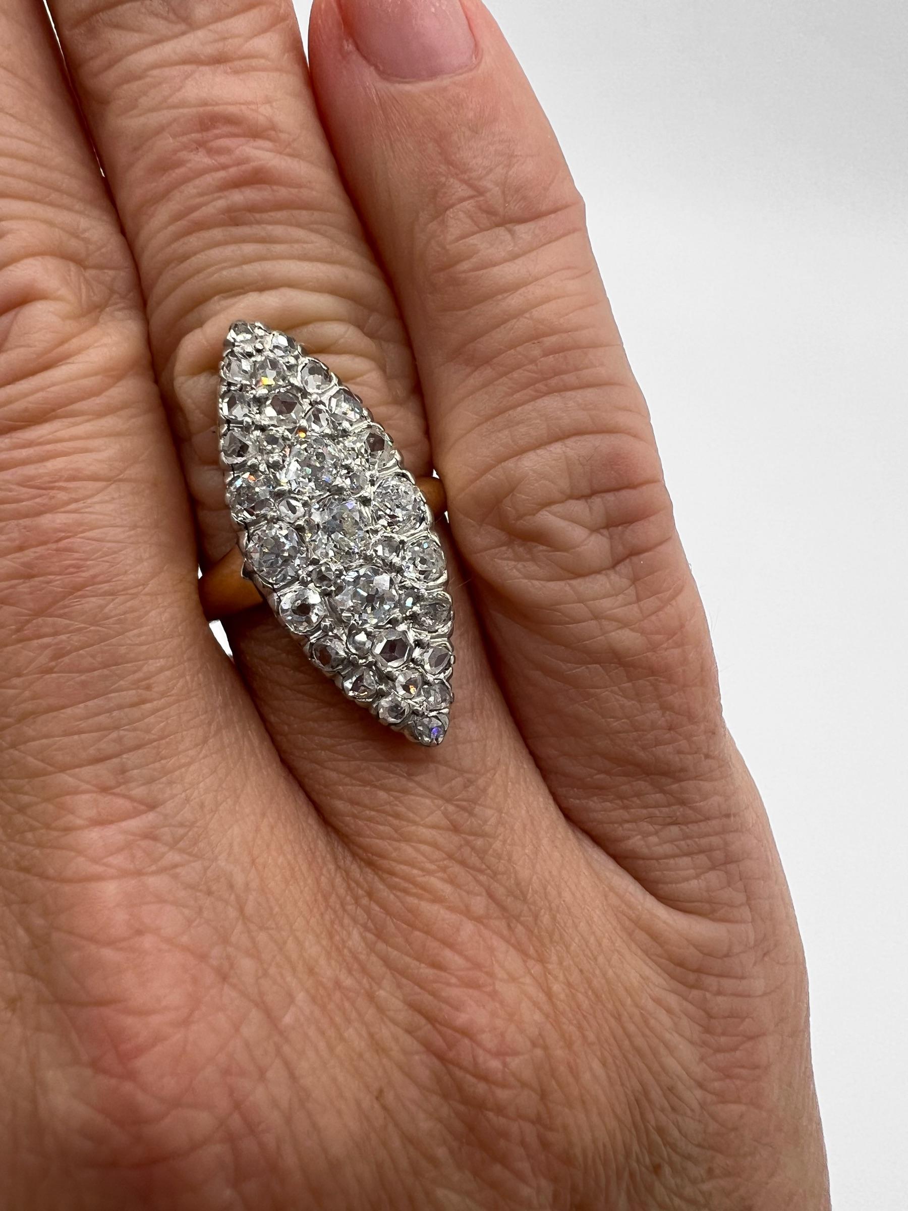 Anillo 