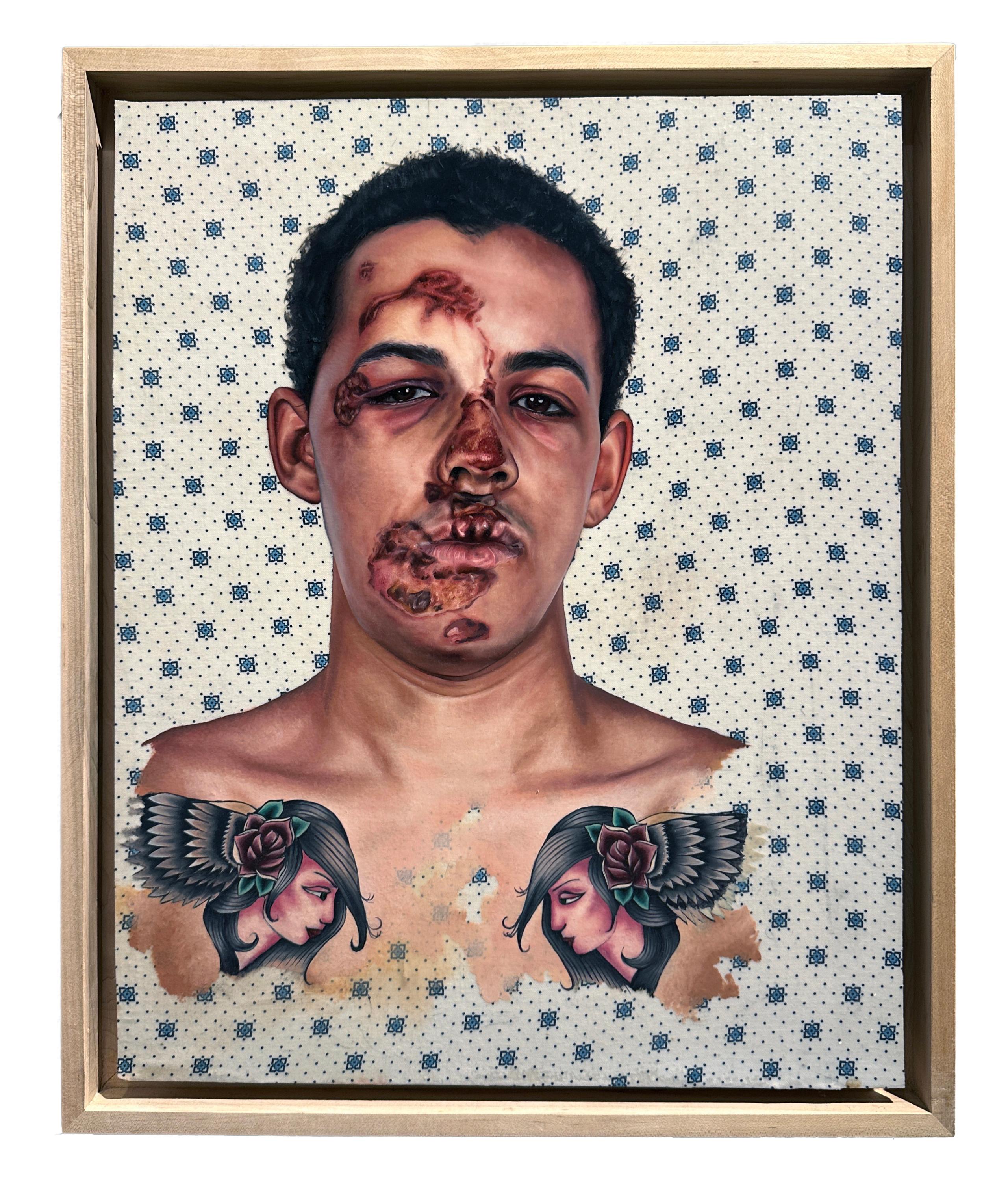 Bike Crash (Portrait of Langston) - Oil on Hospital Gown, Painting, Framed