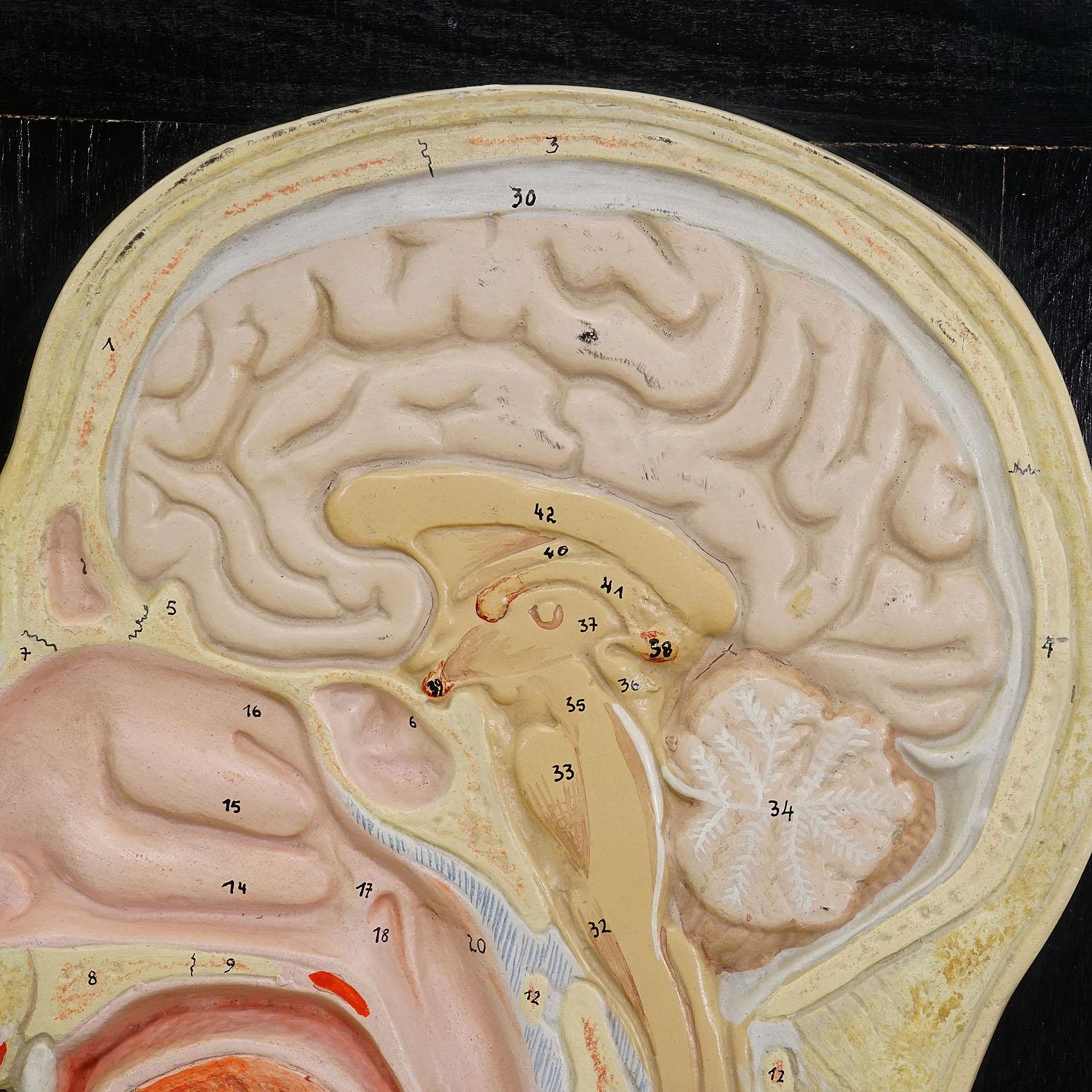 Incisione mediana della testa umana modellata da PHYWE anni '30 In condizioni buone in vendita a Berghuelen, DE
