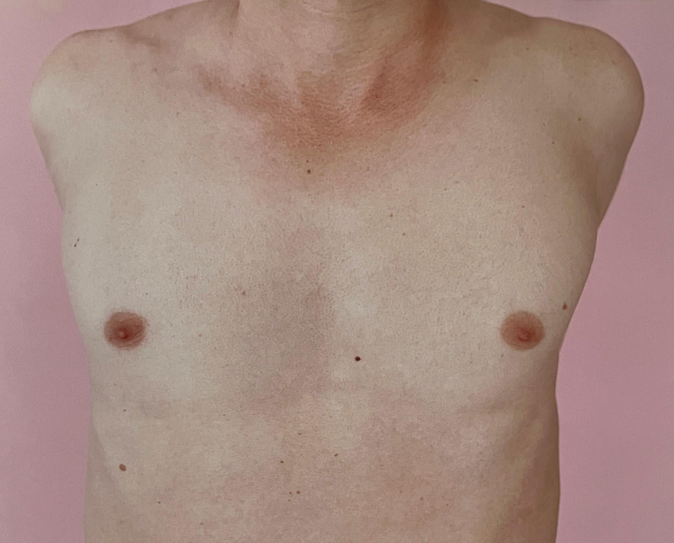 Kouros Torso Pink, by Michael James O’Brien
Color fiber paper
Paper size: 24 H x 20 W inches.
Ed 3/5 + 2AP
Unframed 

Medium format color neg film
Photographed with Pentax 6 x 7 camera In natural light 
_________________

Michael James O’Brien is a