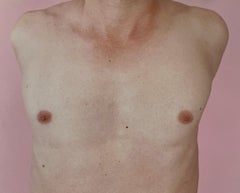 Kouros Torso Pink. Nude Photograph Limited Edition