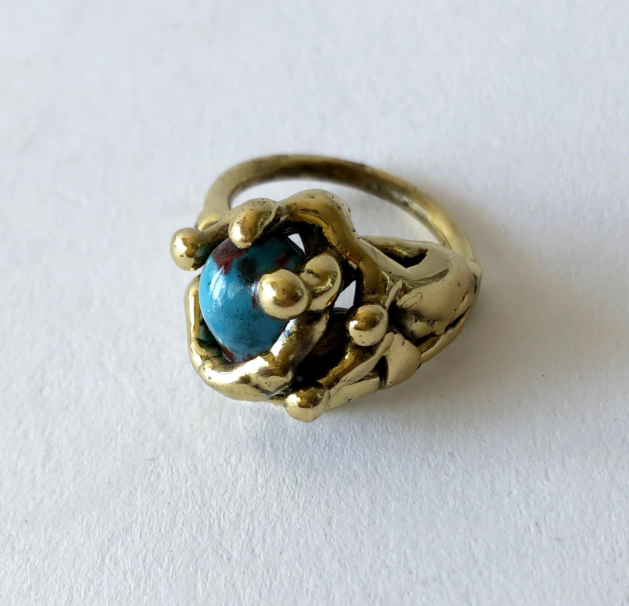 ring fused to man's finger