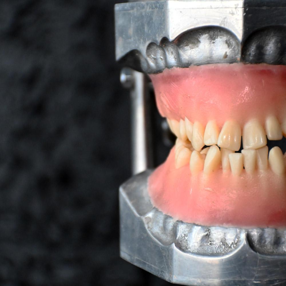 Metal Mid-20th Century English Dental Phantom Display