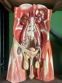 Museum-Quality 19th Century Anatomical Plaster Torso Model, Probably Sommer