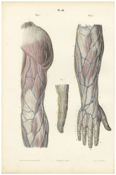 Nerven des Oberarms und der Hand, antiker Anatomiedruck von Hirschfeld, 1866