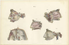 Nerves of the Nose, Palate and Upper Jaw, Antique Hirschfeld Anatomy Print, 1866