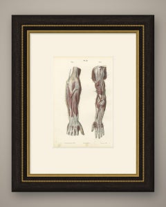Nerves of the Whole Upper Limb, Antique Hirschfeld Anatomy Print, 1866
