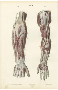 Nerves of the Whole Upper Limb, Antique Hirschfeld Anatomy Print, 1866