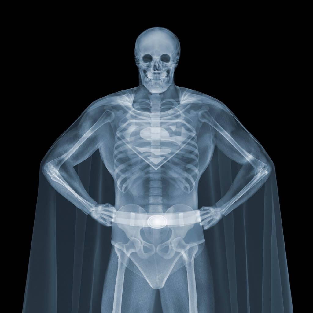 Nick Veasey Abstract Photograph - Superman