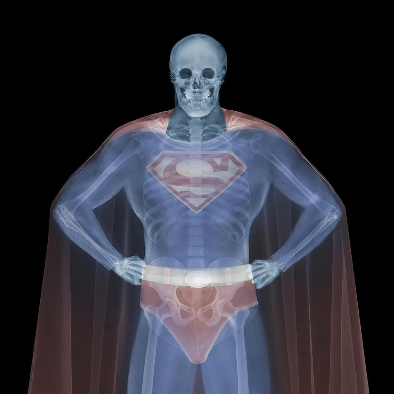 Nick Veasey Black and White Photograph - Clark To superman in Color, Lenticular 
