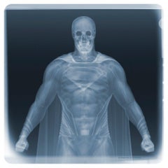 Examination of Superman/  X-Ray Print / Photography  / Radiographic Imaging