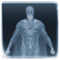 Examination of Superman/ X-Ray Print / Photography / Radiographic Imaging