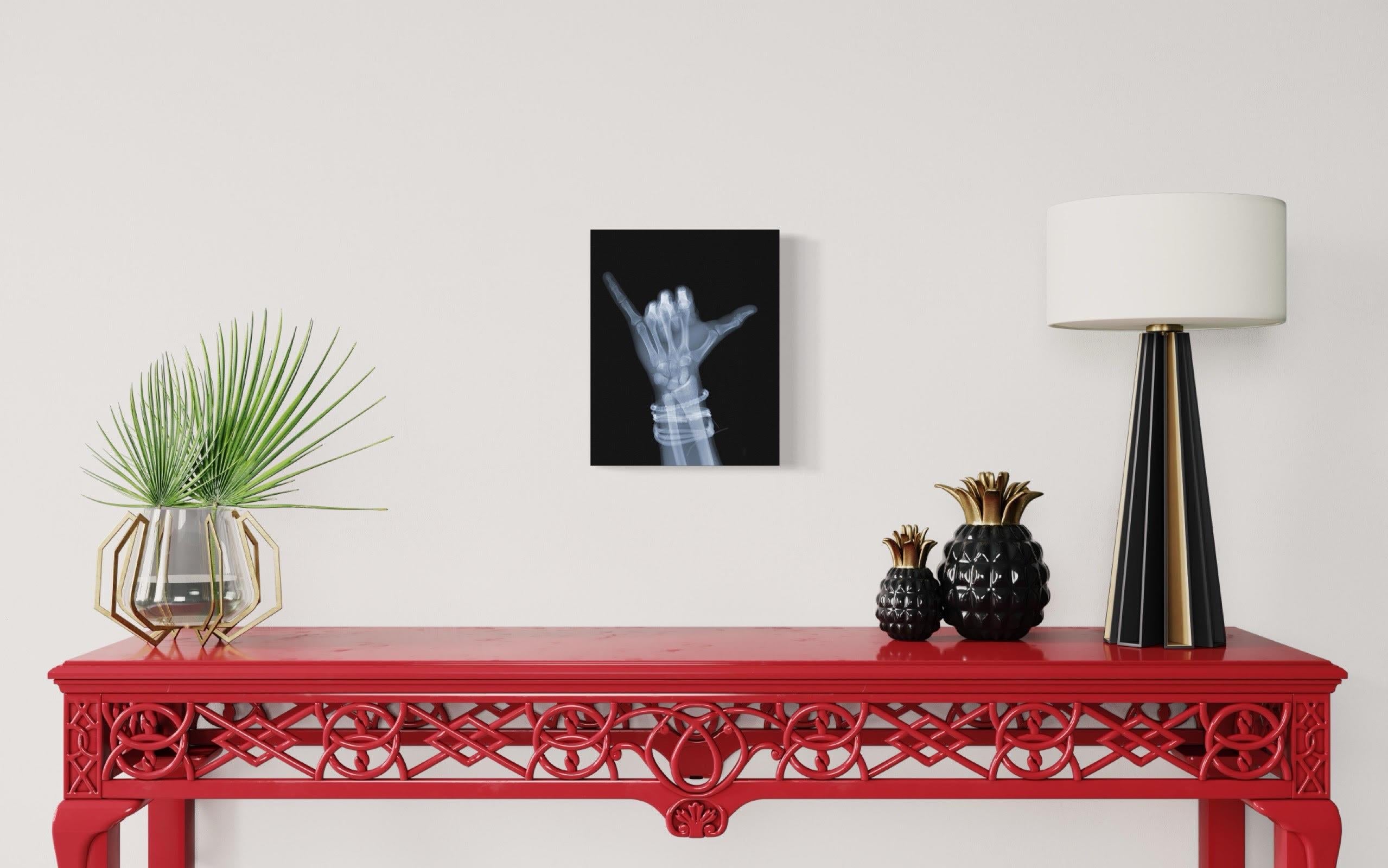 x ray of hand