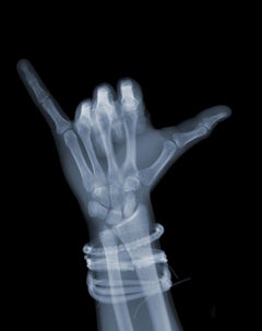 Hang Loose / X-Ray Print / Radiographic Imaging of a Hand 