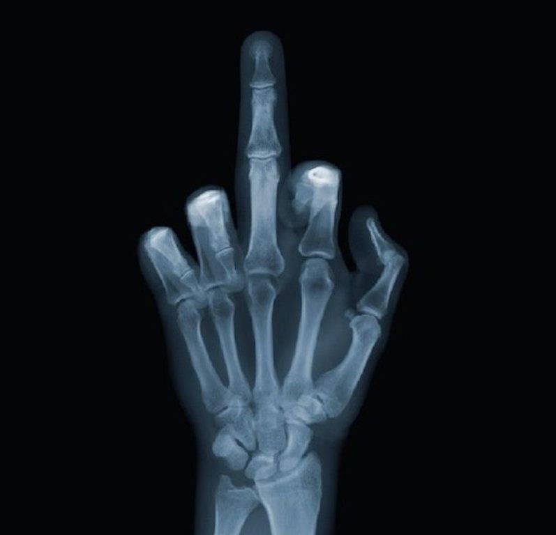 The Finger - Mixed Media Art by Nick Veasey