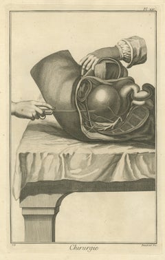 Opened Abdomen and Bladder Dissection, Diderot Chirurgie Plate XIV, circa 1772