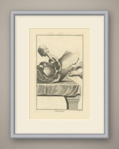 Opened Bladder with Instruments, Diderot Chirurgie Second Plate XIV, circa 1772