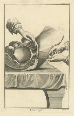 Opened Bladder with Instruments, Diderot Chirurgie Second Plate XIV, circa 1772