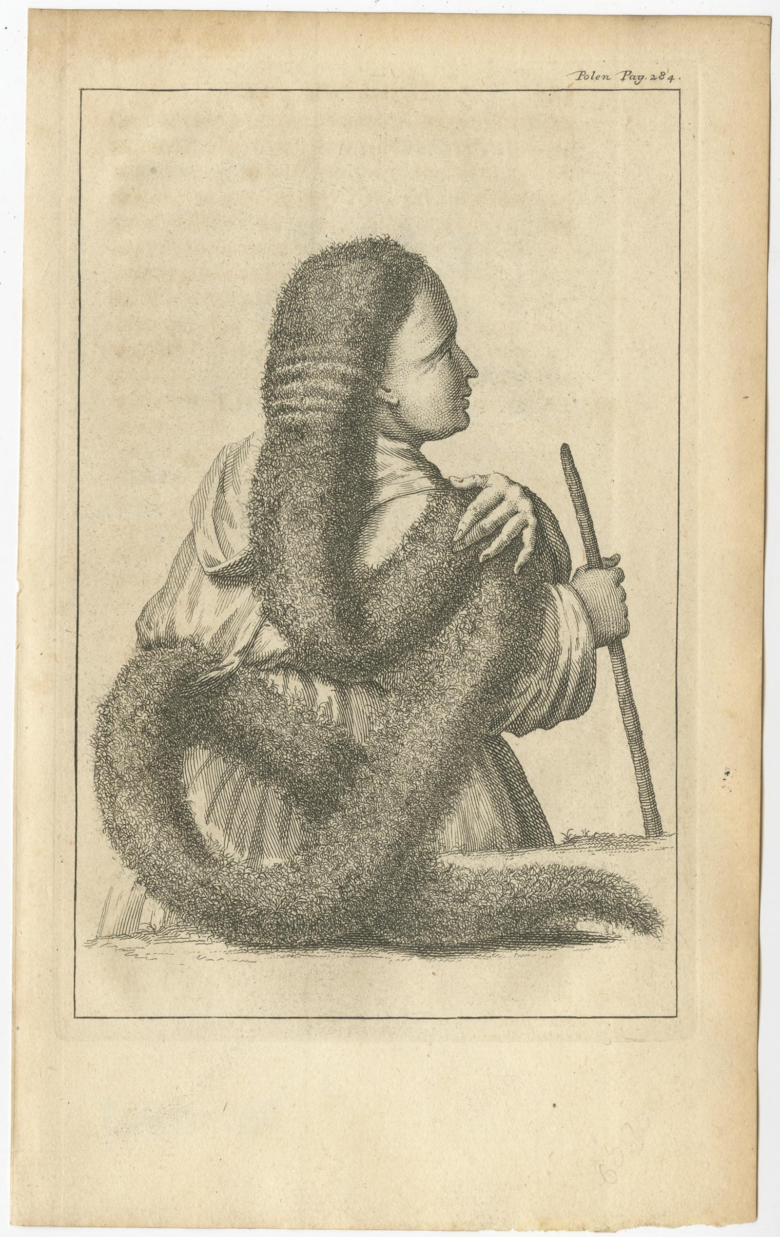 Description: Untitled Print of a Polish Plait. Polish plait ( Plica polonica in Latin), plica, or trichoma is a formation of hair. 

This term can refer to a hairstyle or supposes a medical condition. It also relates to the system of beliefs in