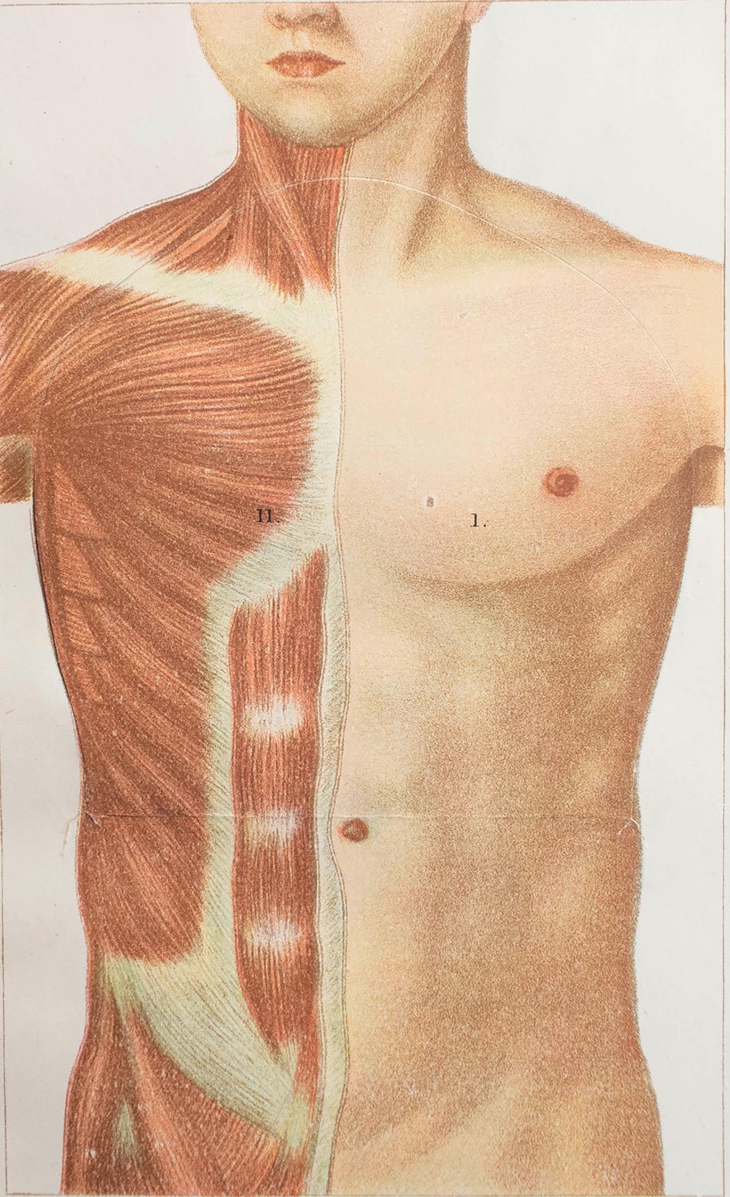 Great image of medical interest.

Unframed.

Published, circa 1900.





