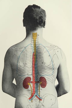 Original Vintage Medical Print- Kidneys, C.1900