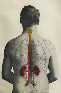 Original Vintage Medical Print- Kidneys, C.1900