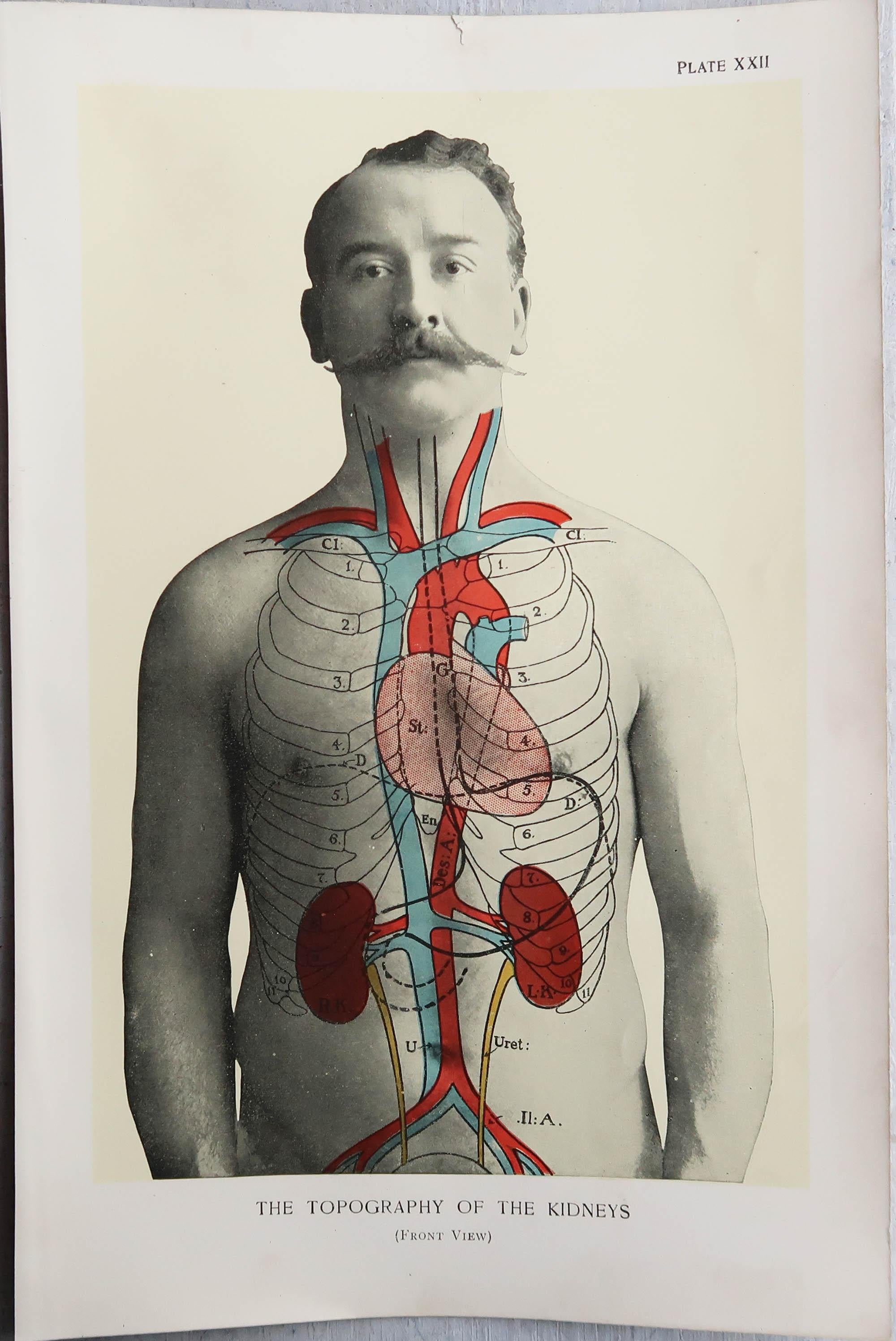 Edwardian Original Vintage Medical Print, Kidneys, C.1900
