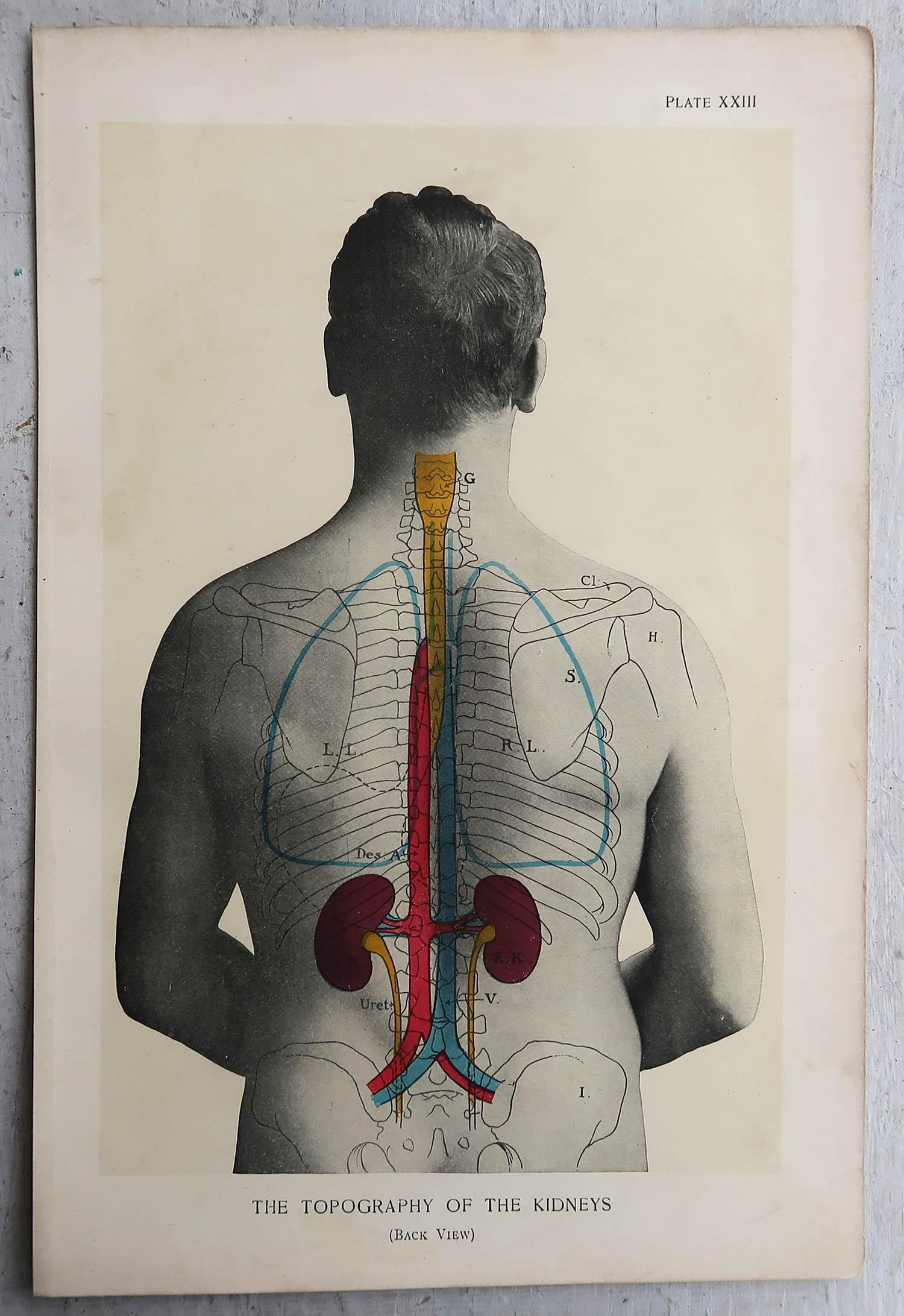 Edwardian Original Vintage Medical Print- Kidneys, C.1900