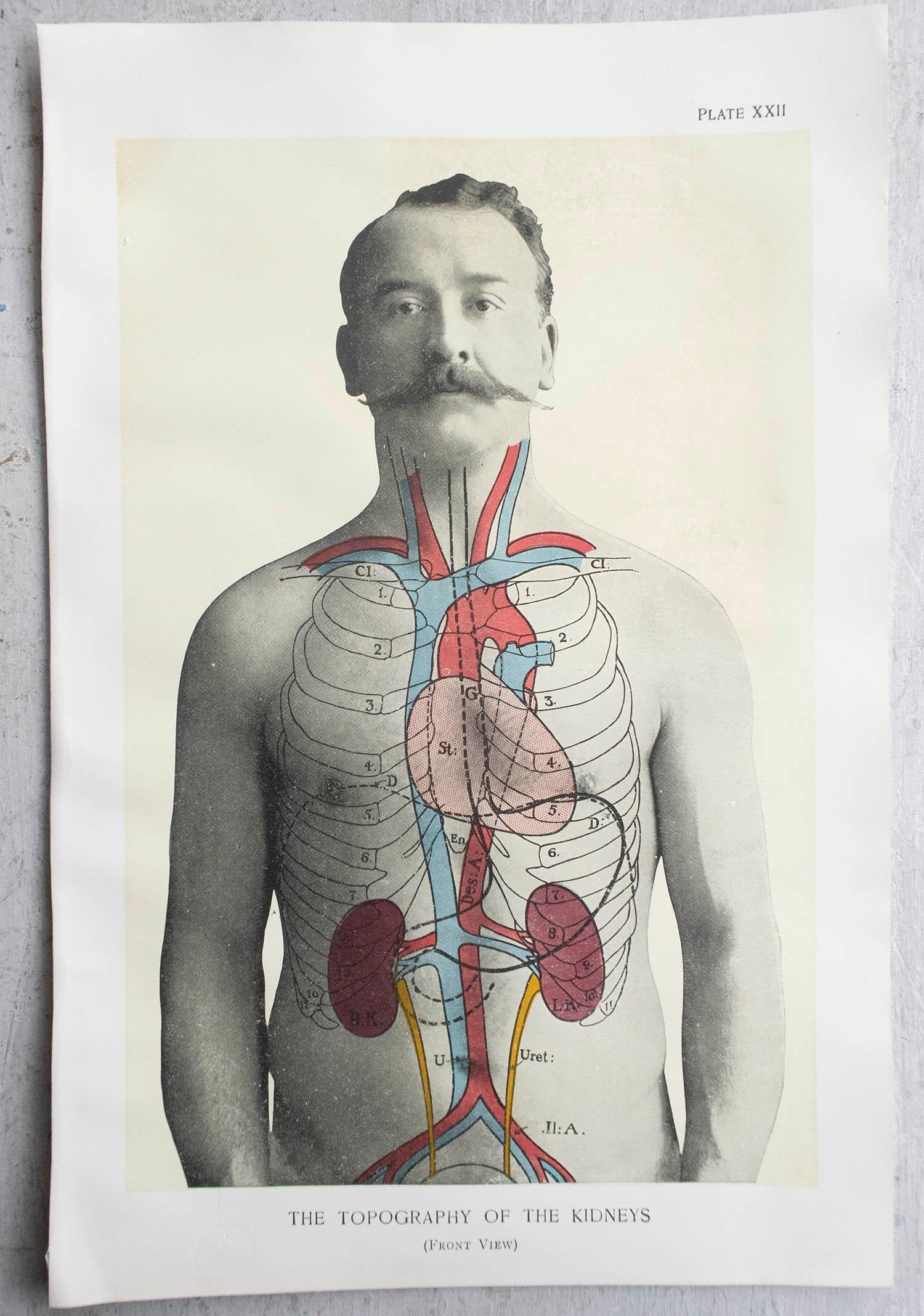 Edwardian Original Vintage Medical Print, Kidneys, C.1900 For Sale