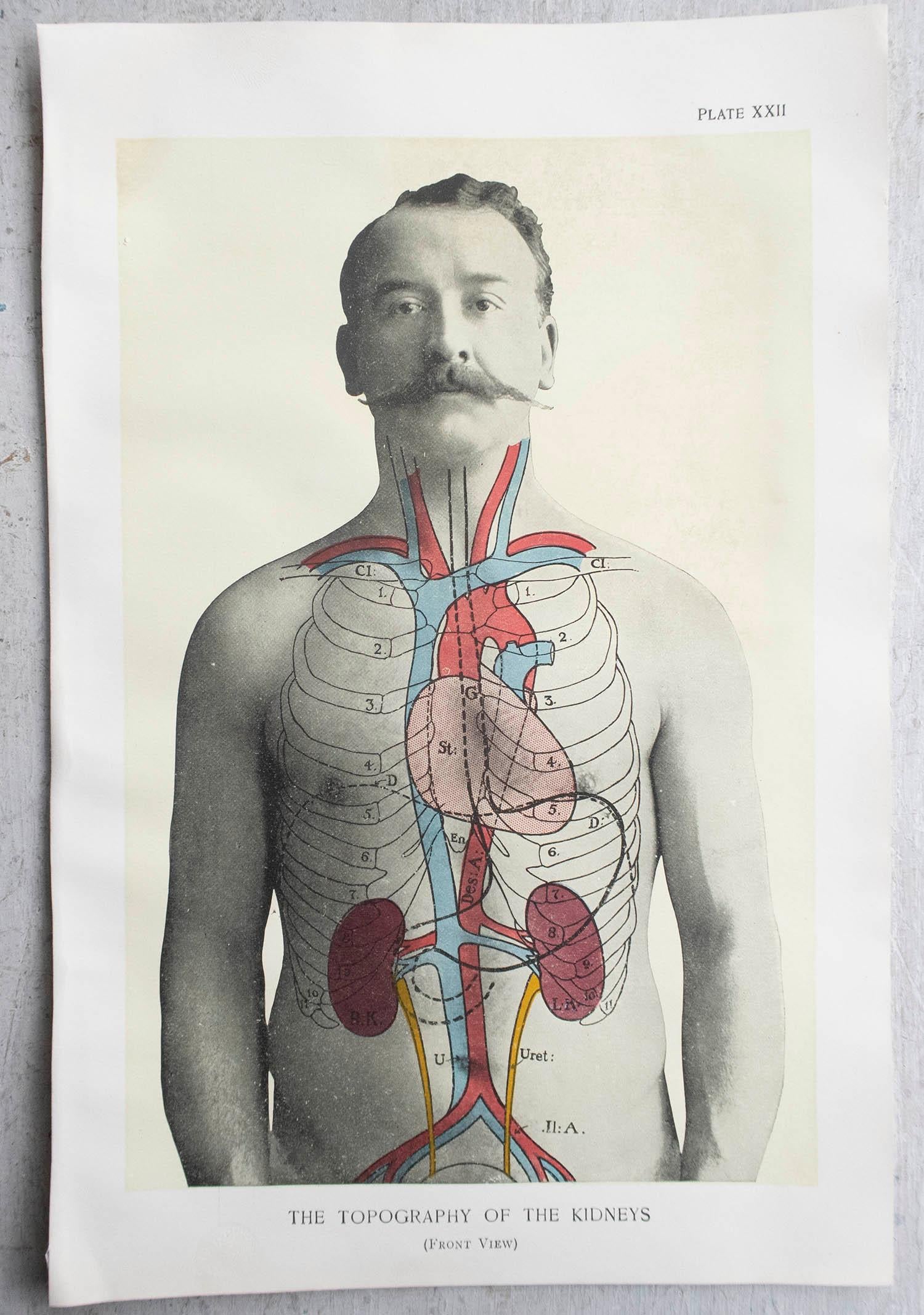 Edwardian Original Vintage Medical Print, Kidneys, C.1900