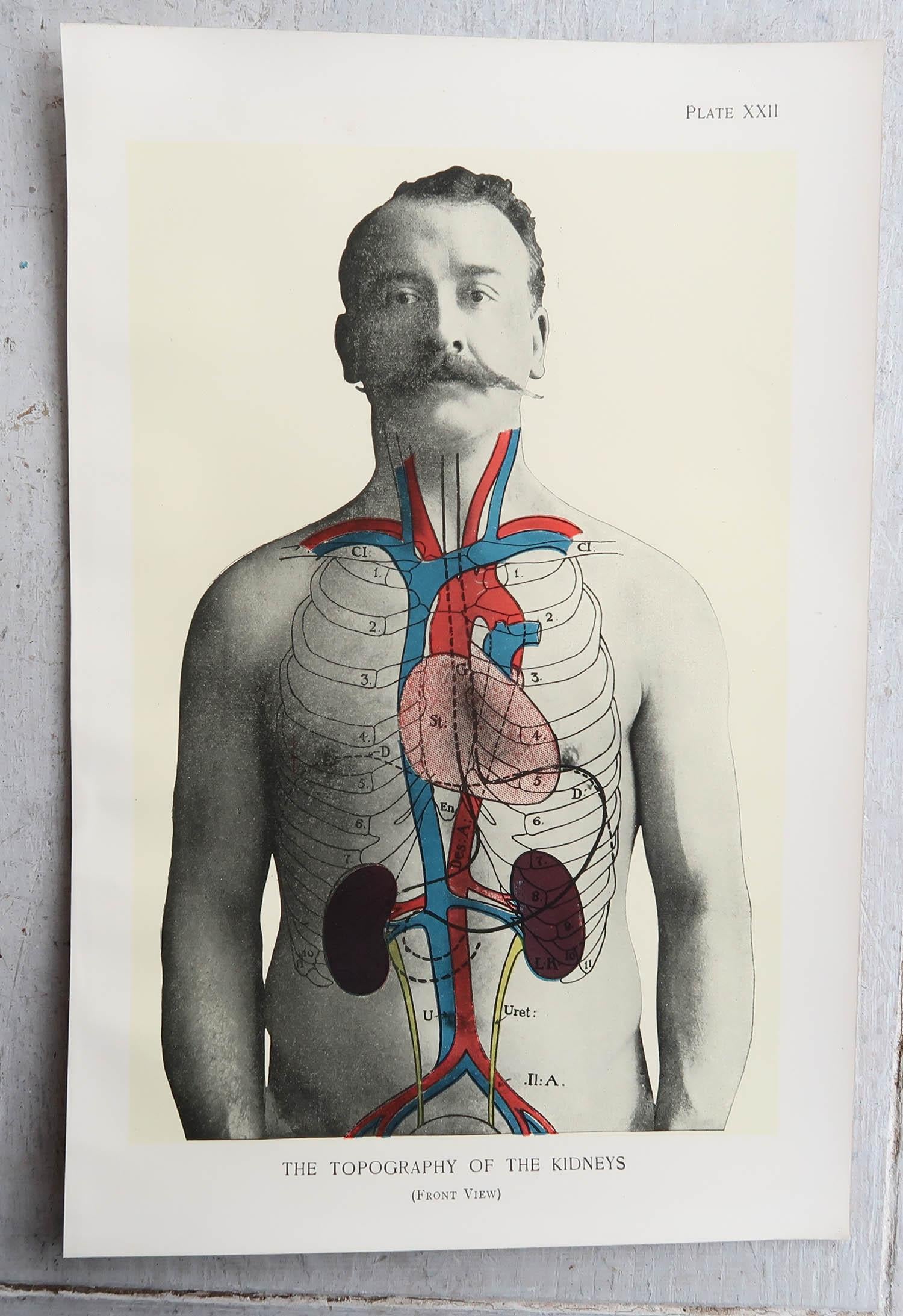 English Original Vintage Medical Print, Kidneys, C.1900