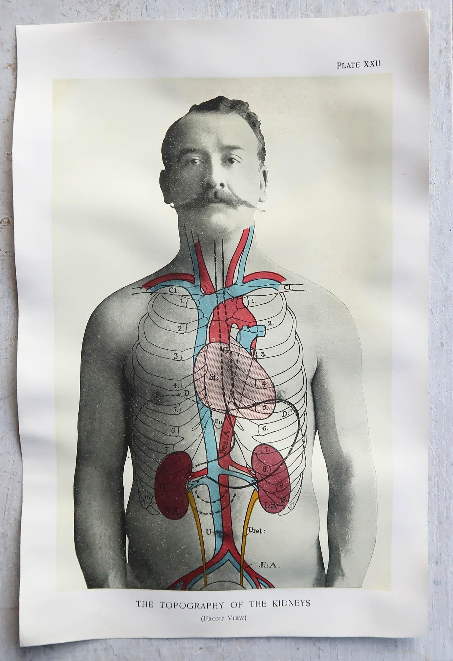 English Original Vintage Medical Print, Kidneys, C.1900 For Sale
