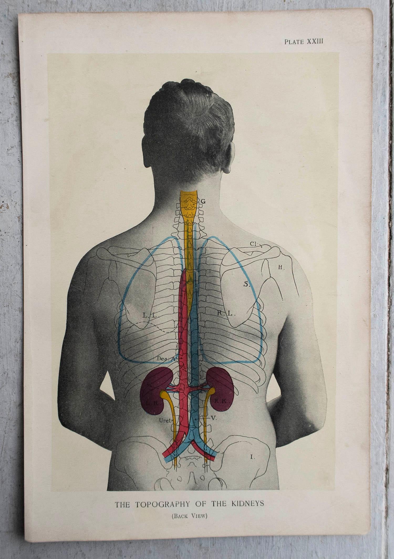 English Original Vintage Medical Print- Kidneys, C.1900 For Sale