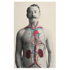 Original Antique Medical Print, Kidneys, C.1900