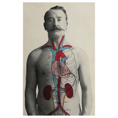 Original Antique Medical Print, Kidneys, C.1900