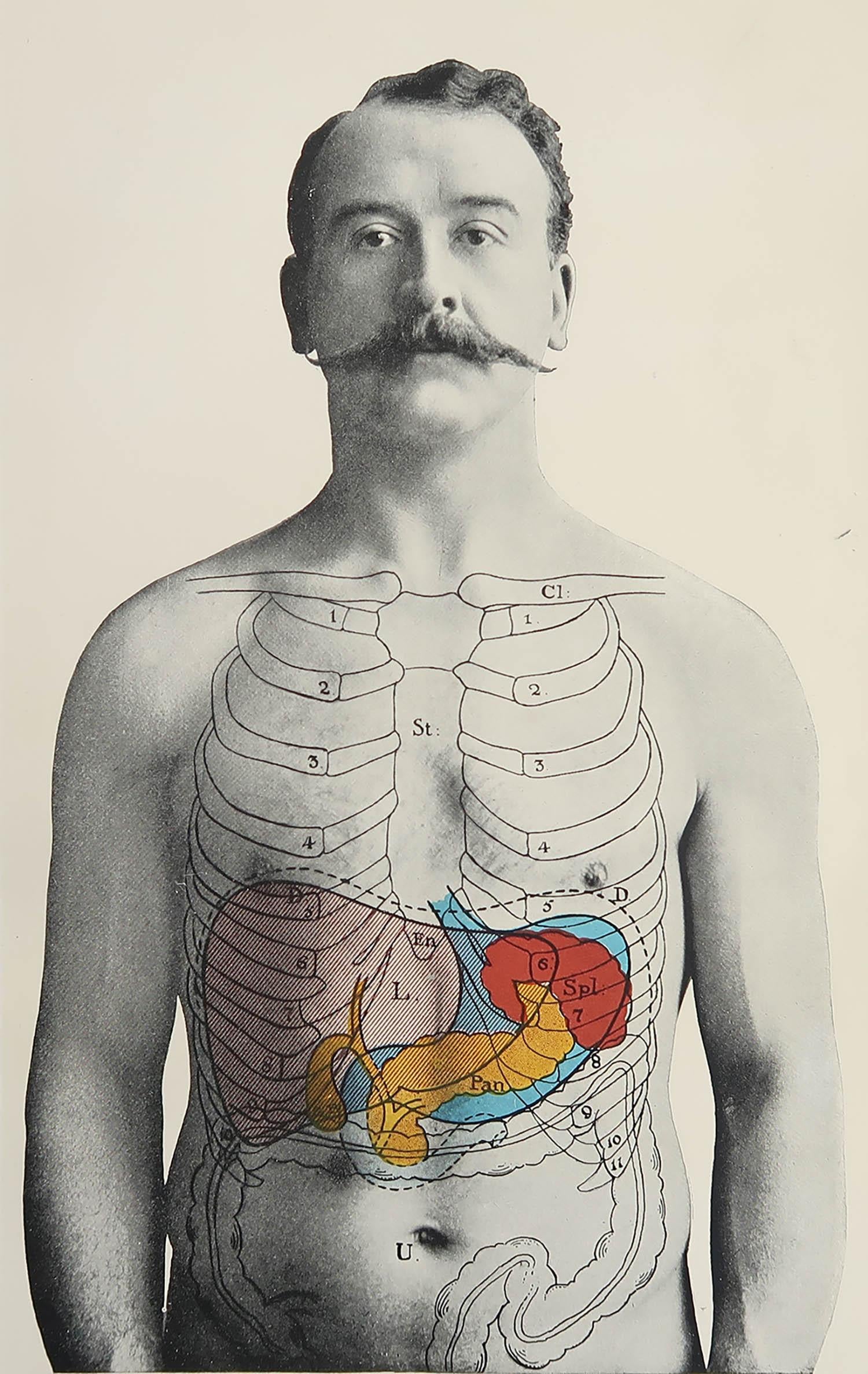 Great image of medical interest.

Unframed.

Published, circa 1900.





.