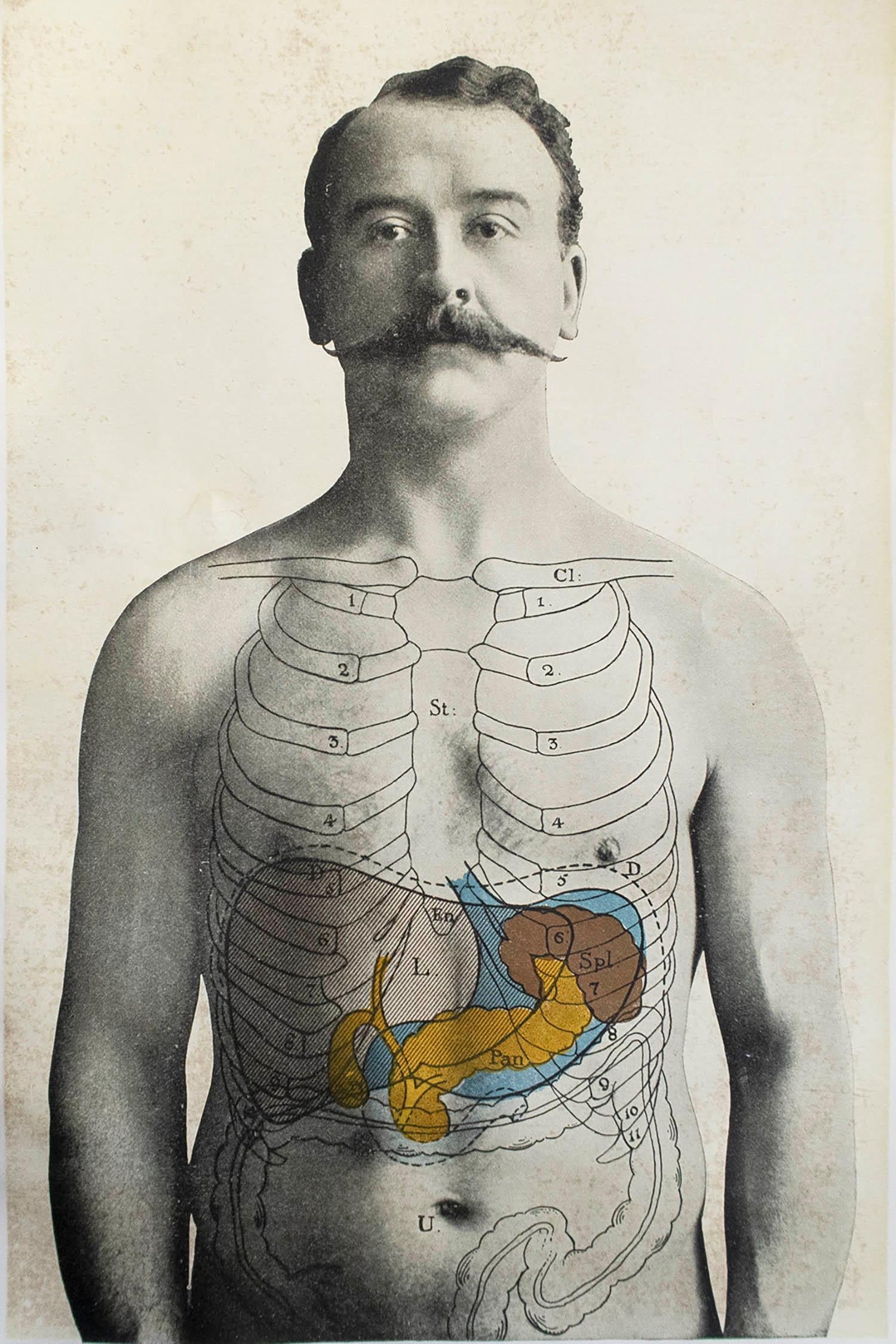 Großartiges Bild von medizinischem Interesse.

Ungerahmt.

Veröffentlicht, um 1900.





.
