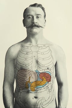 Original Vintage Medical Print, Liver, Spleen and Pancreas, circa 1900