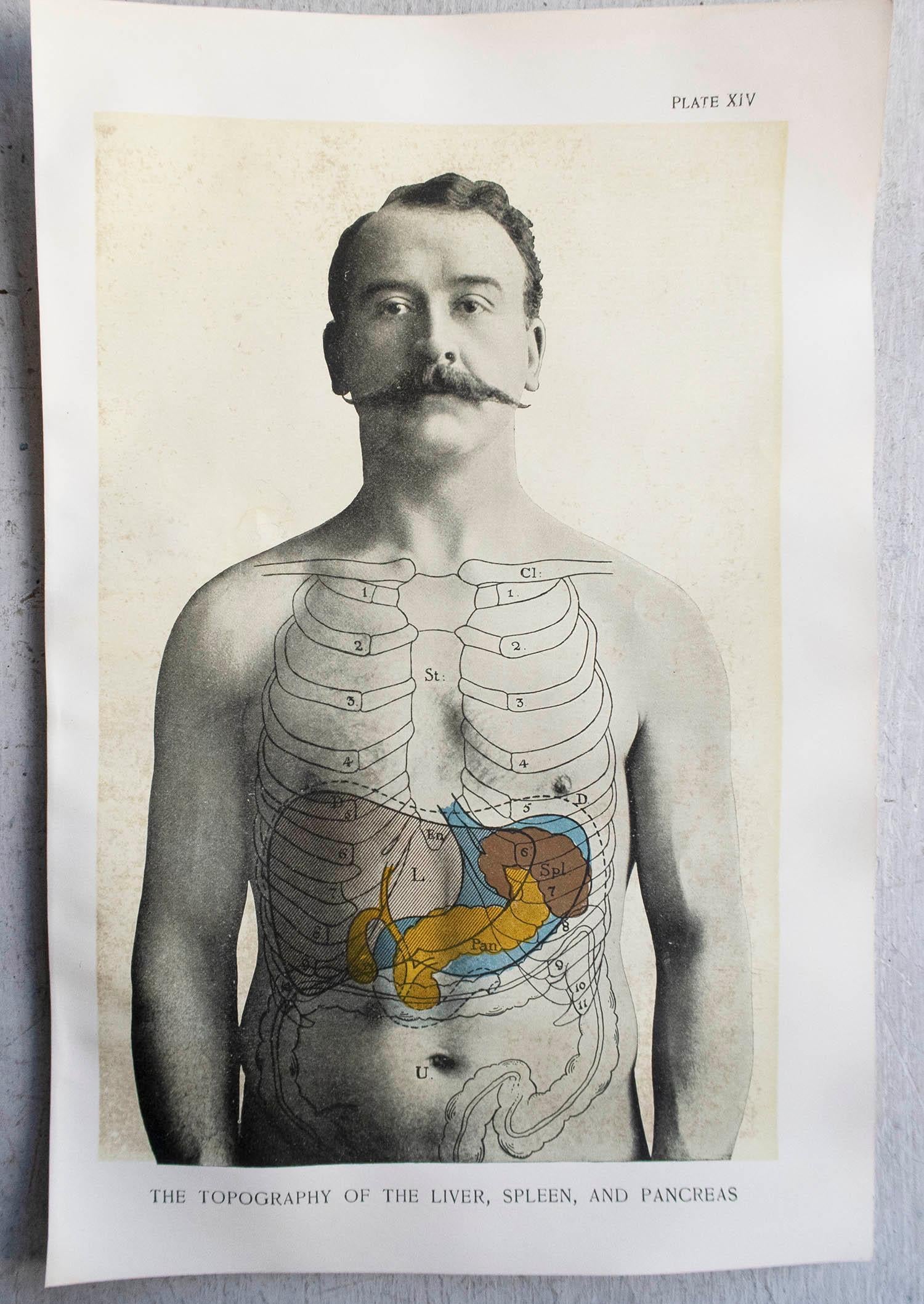 Edwardian Original Vintage Medical Print, Liver, Spleen and Pancreas, circa 1900 For Sale