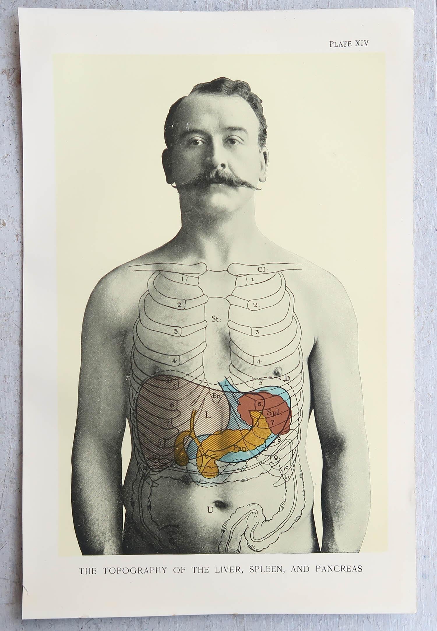 Originaler medizinischer Vintage-Druck, Liver, Spleen und Pancreas, um 1900 (Edwardian) im Angebot