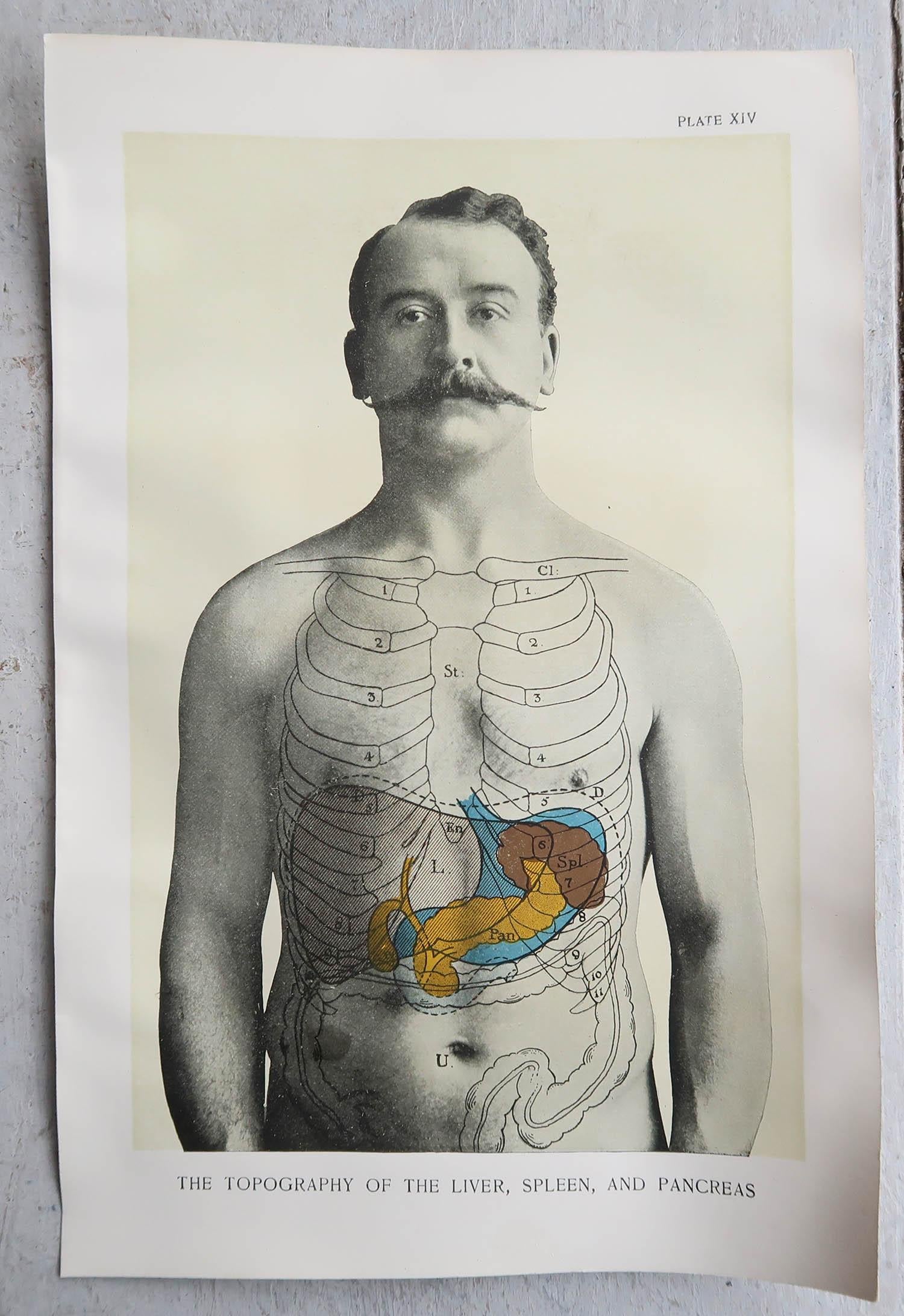 English Original Vintage Medical Print, Liver, Spleen and Pancreas, circa 1900