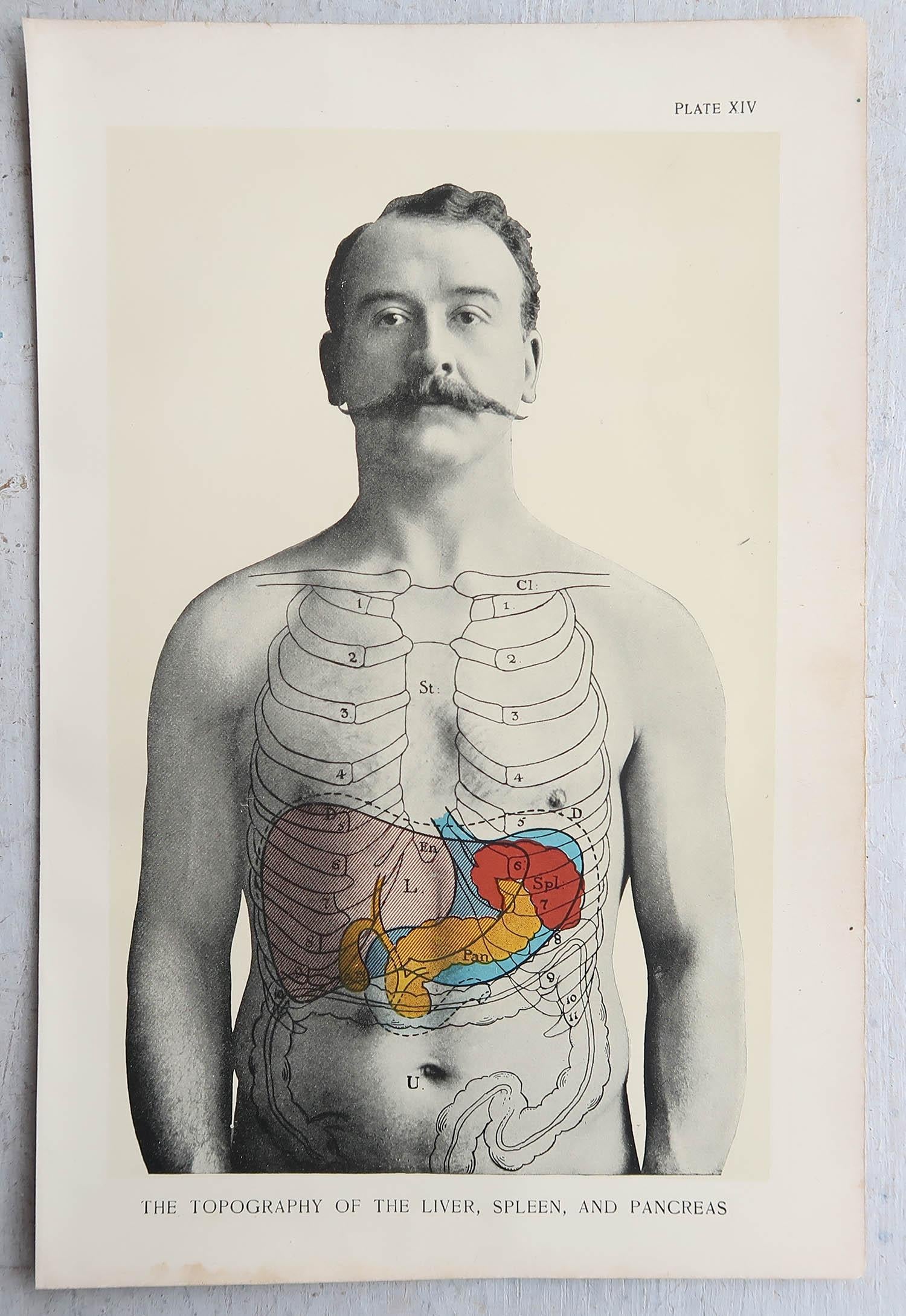 English Original Vintage Medical Print, Liver, Spleen and Pancreas, circa 1900