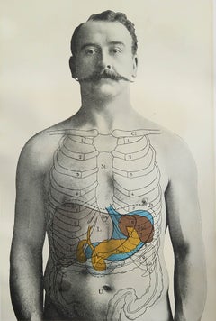 Original Vintage Medical Print, Liver, Spleen and Pancreas, circa 1900