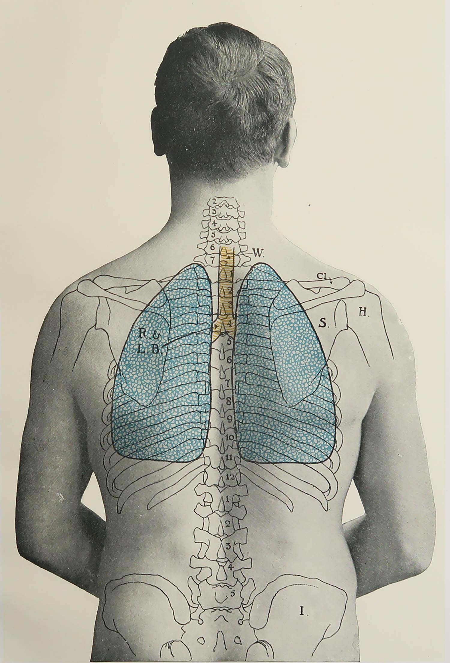 Great image of medical interest.

Unframed.

Published, circa 1900.





