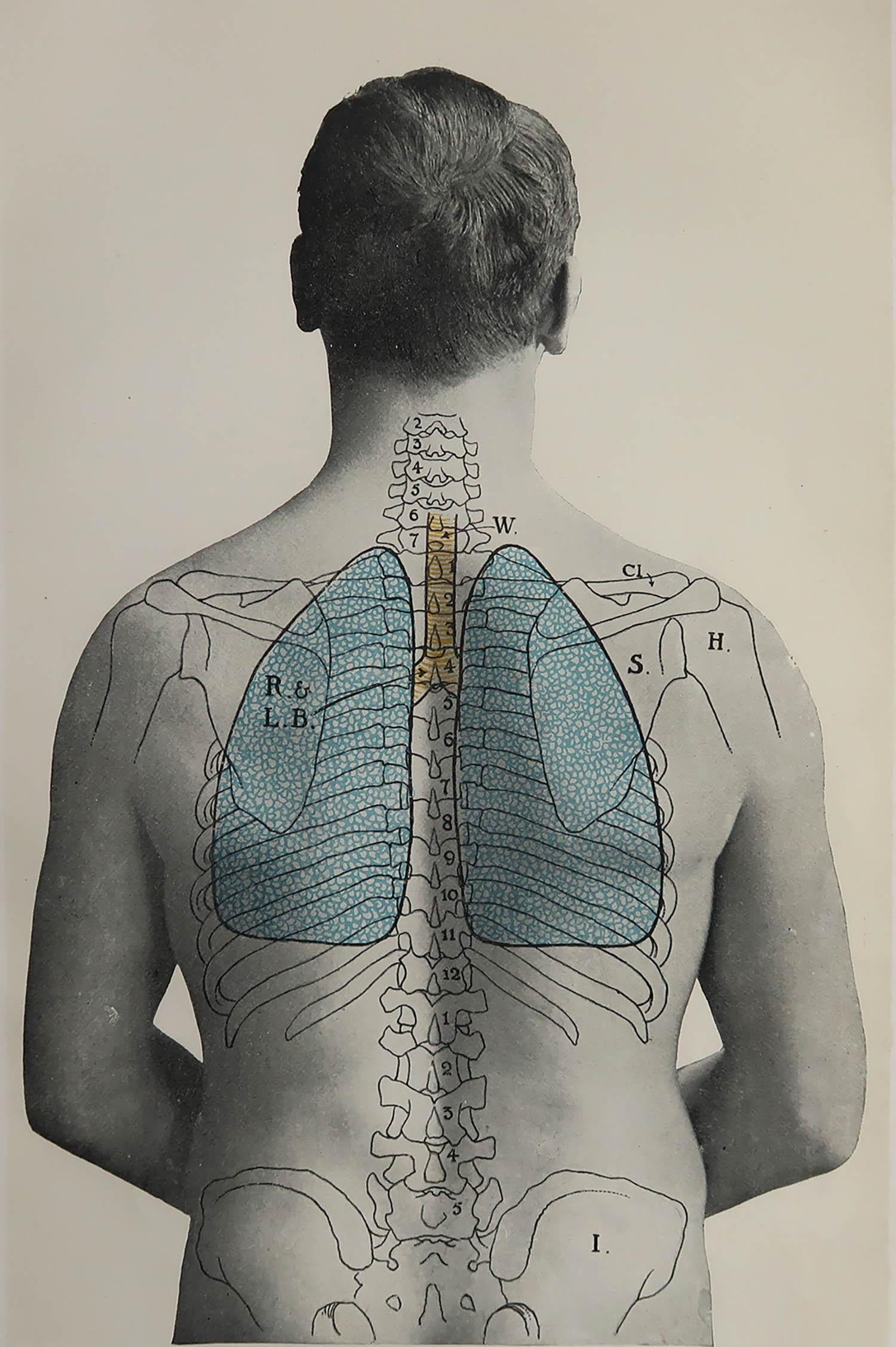 Great image of medical interest.

Unframed.

Published, circa 1900.

Repair to a minor tear on bottom edge





