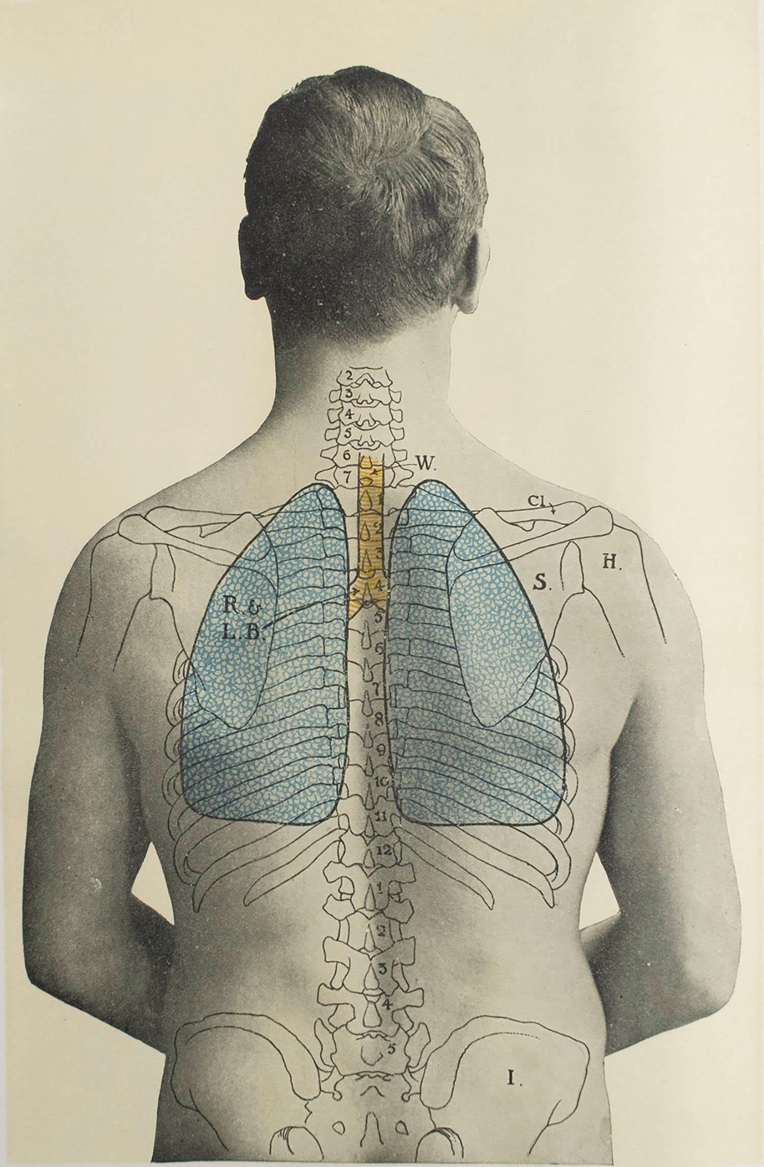 Großartiges Bild von medizinischem Interesse.

Ungerahmt.

Veröffentlicht, um 1900.







