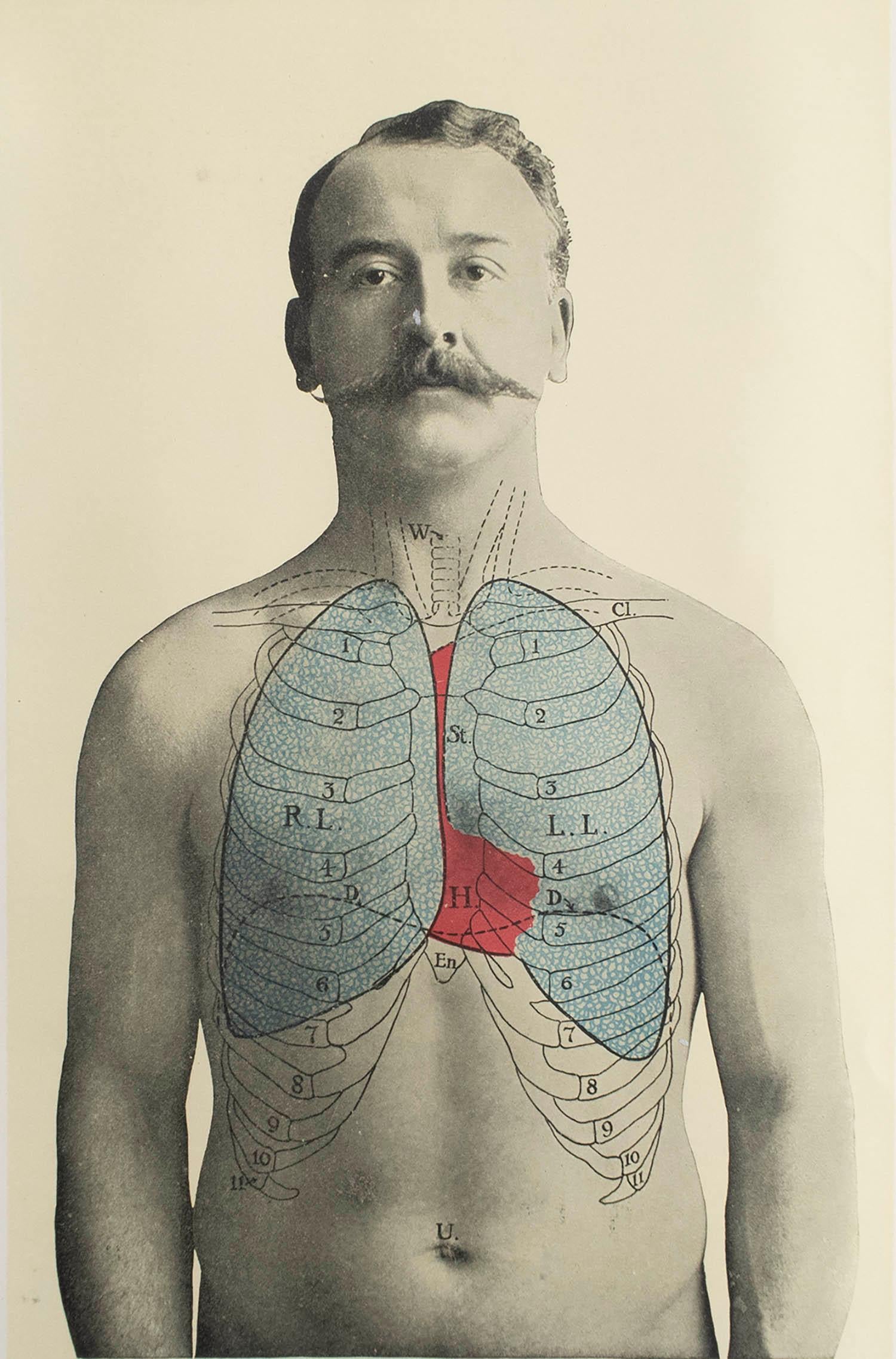 Großartiges Bild von medizinischem Interesse.

Ungerahmt.

Veröffentlicht, um 1900.





